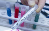 Assam: 51 more test positive for Covid-19; Total tally at 1672