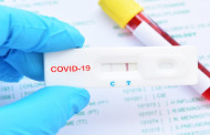 18 more test positive for Covid-19 in Tripura, total tally 916