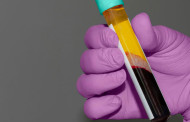 Guest status for plasma donors in Assam