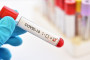 India’s coronavirus cases near 7mn