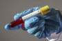43,99,324 registered to receive COVID-19 vaccines
