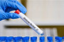 Global Covid-19 cases near 300 million amid omicron surge