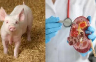 Scientists grow human-like kidneys in pigs