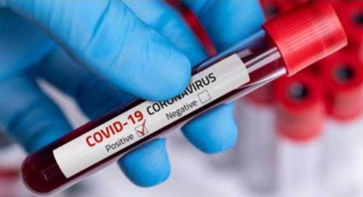 Another doctor tests positive for COVID19 in Tripura