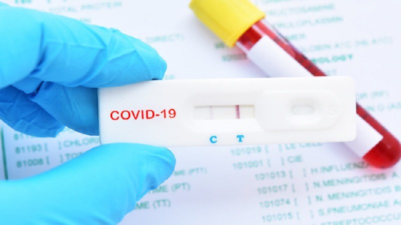 18 more test positive for Covid-19 in Tripura, total tally 916