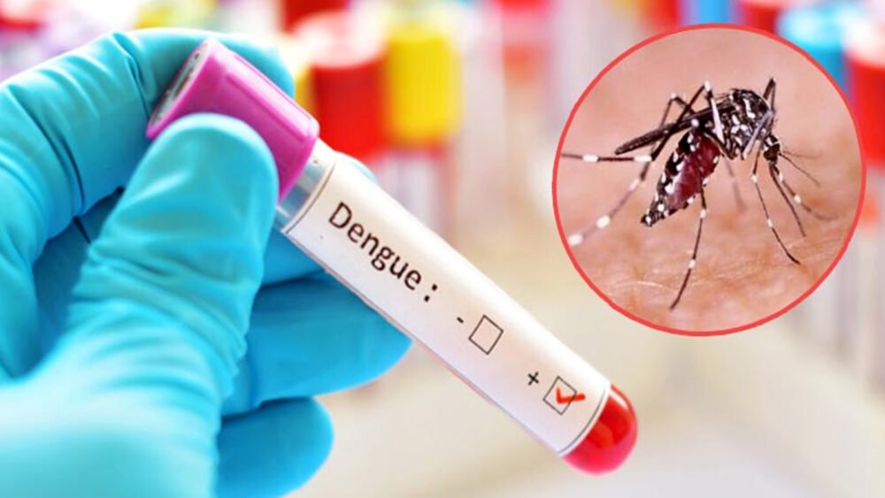 17 dengue patients die, 1770 hospitalised in 24 hrs