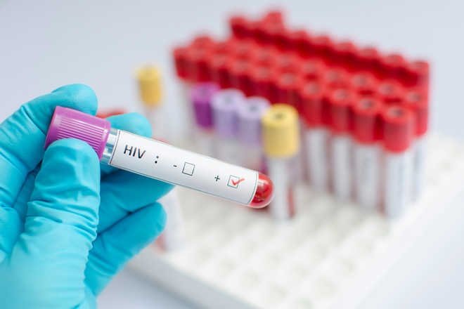 HIV cases rise in Tripura: 5,269 confirmed, 576 students test positive